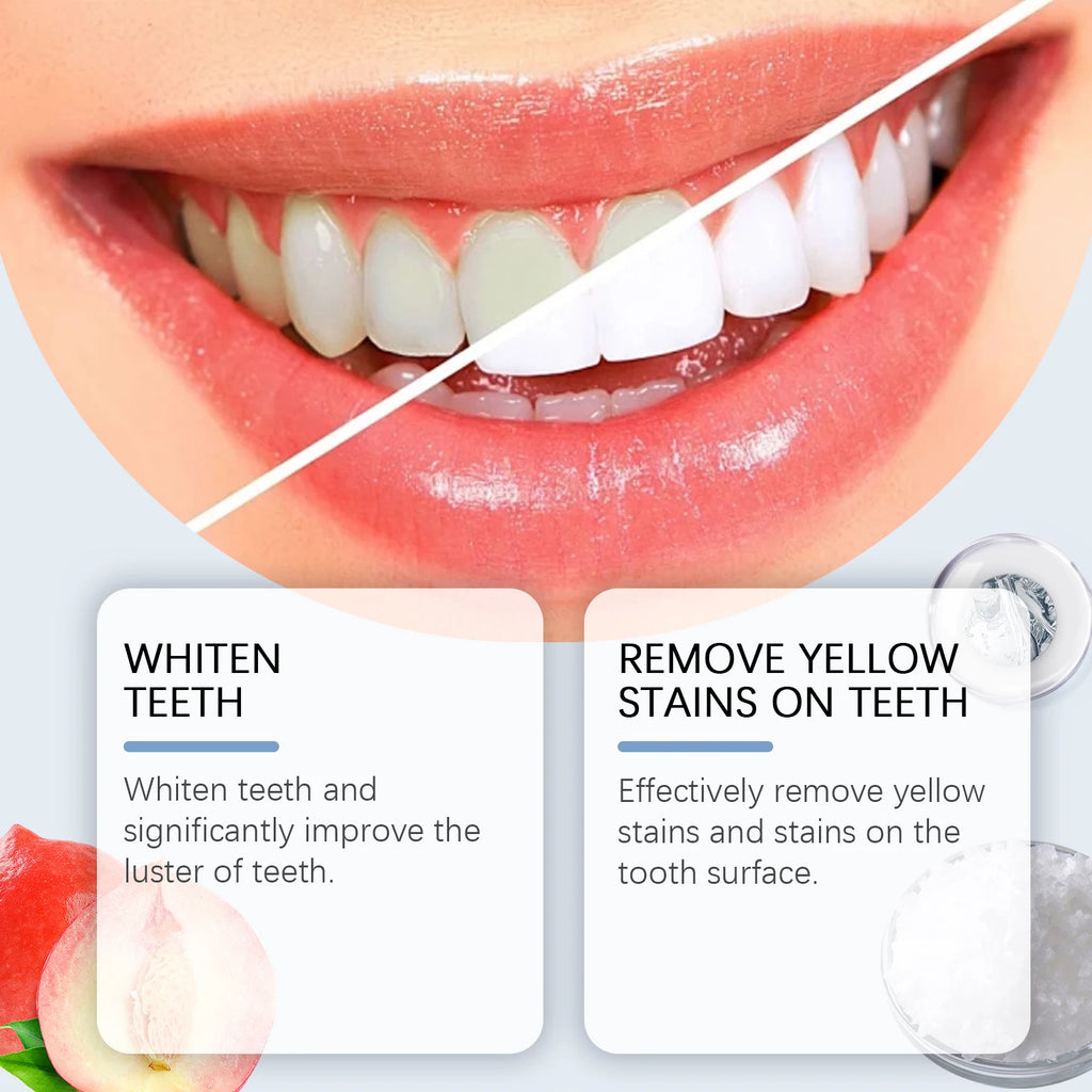Oralhoe 100g Niacinamide dentifrice blanchissant éclaircir les dents nettoie les dents les tache bouche haleine fraîche hygiène buccale dentifrice blanchissant
