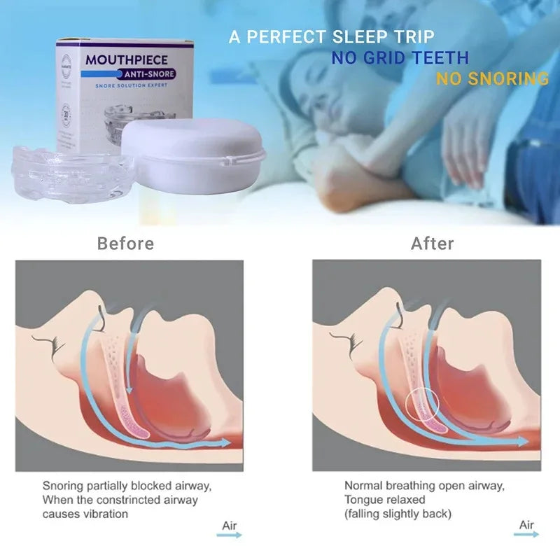 Protège-dents anti-ronflement Bruxisme Améliorer la qualité du sommeil Anti-ronflement et apnée Dispositif de ronflement Protège-dents avec boîte de rangement