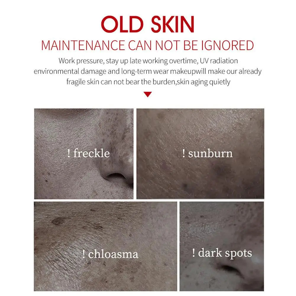 Crème pour le visage Blanchiment des taches de rousseur Éliminer la crème pour le visage Éliminer le noir, le mélasma Taches sombres Dépôts d’acné VE Nourrir Éclaircir les soins de la peau
