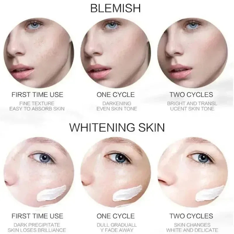1/3/5 pièces crème blanchissante pour les taches de rousseur Niacinamide élimine les taches foncées crème Anti-taches de rousseur et vieillissement estompe Pigmentation Melasma peau